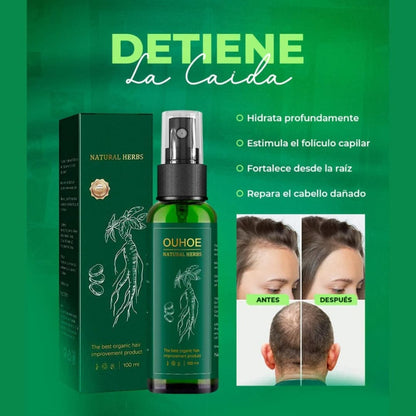 OUHOE® 100ML- ELIXIR PARA EL CRECIMIENTO DEL CABELLO